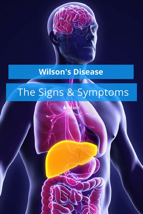 Wilson's Disease | Wilson's disease, Disease symptoms, Autoimmune disease