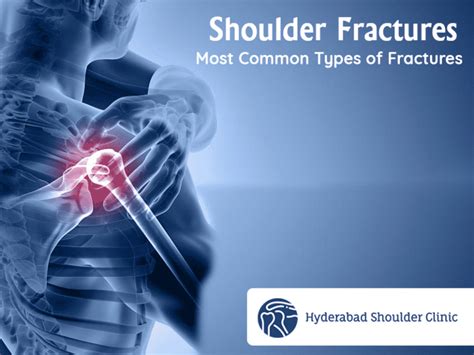 shoulder fracture symptoms - shoulder clinic Hyderabad