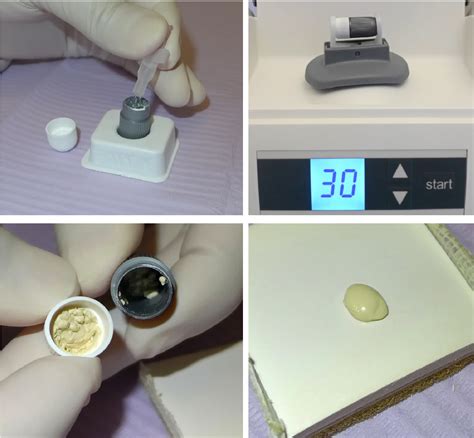 Figure 3 from Bioceramic materials in endodontics | Semantic Scholar