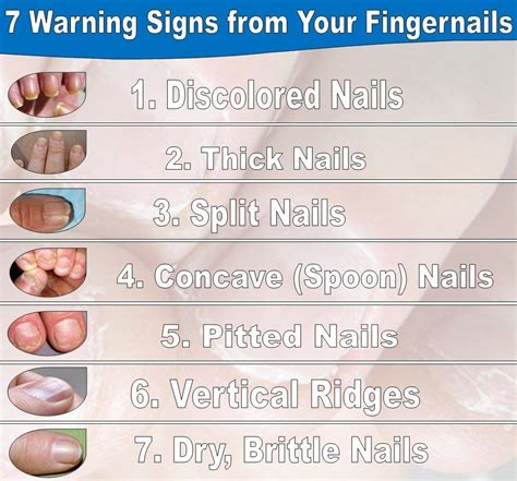 This is What Your Fingernails Are Warning You About Your Health ...