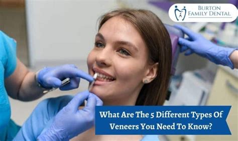 5 Different Types Of Dental Veneers And Its Good Points