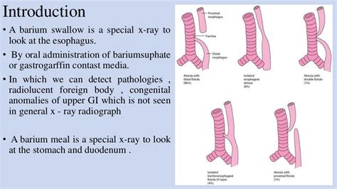 Procedure of upper gi