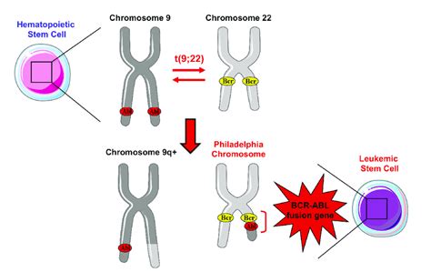 Chronic Myeloid Leukemia (CML)