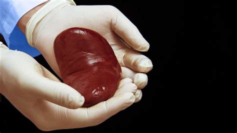 Successful Pig to Human Kidney Transplant - WG Biomedical