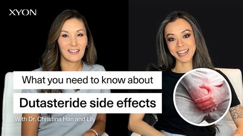 Dutasteride Side Effects: What Are The Side Effects? Do They Go away? - YouTube