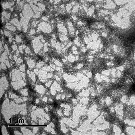 TEM micrograph of the cellulose nanocrystals. | Download Scientific Diagram