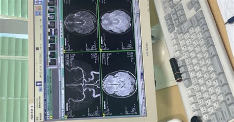 MRI Review | FindATopDoc