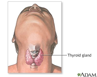 Thyroid gland removal Information | Mount Sinai - New York