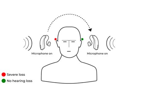 CROS Hearing Aids | BiCROS Hearing Aids