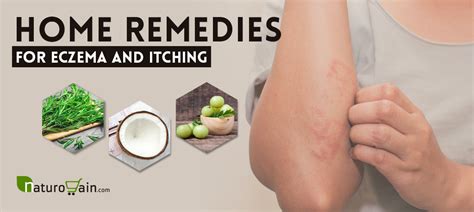 9 Effective and Best Home Remedies for Eczema that Work [Naturally]