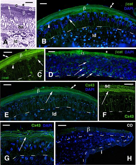 Histology (A) and immunofluorescence for beta-catenin (B–D) and Cx43... | Download Scientific ...