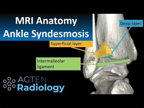 MRI Anatomy of ankle ligaments: Syndesmosis : Radiology