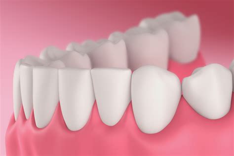 Vardhaman Dental Care | Orthodontic Dentistry