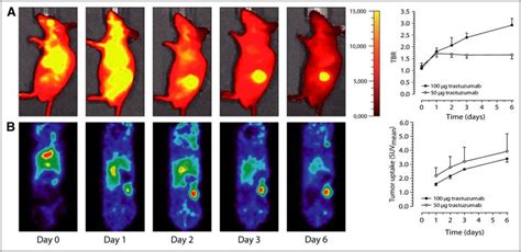 Near Infrared Imaging Market Reaching at US$ 822 Million by 2023 Study ...