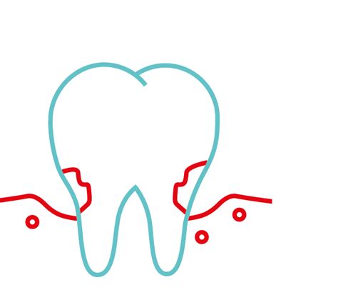 Periodontics - Gum Care - The Dental Hospital | Birmingham