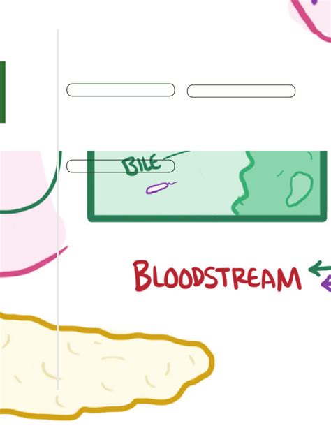 Biliary tract diseases Notes: Diagrams & Illustrations | Osmosis