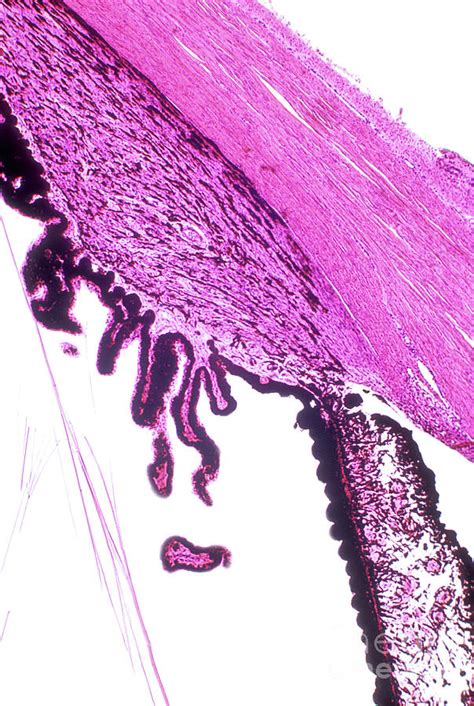 Iris Histology