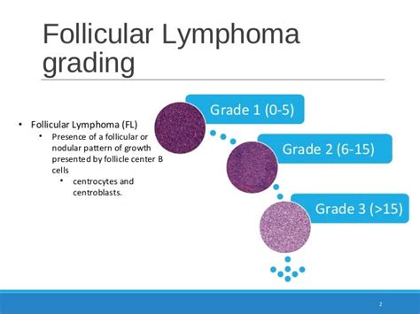 Multi Scale Directional Filtering Based Method for Follicular Lymphom…