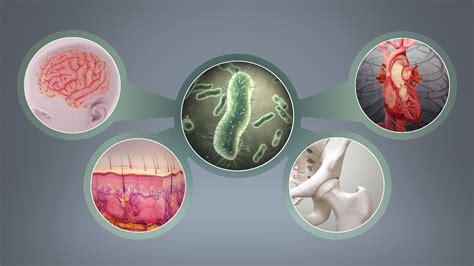 Rheumatic Fever: Symptoms, Causes, and Treatment - Scientific Animations