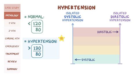 Hypertension: Pathology review: Video & Anatomy | Osmosis