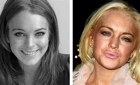 15 Famous Drug Addicts: Before and After Pictures - TSMP Medical Blog