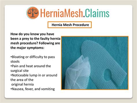 Claims For Serious Injuries & Complications | Hernia Mesh Claims | PPT