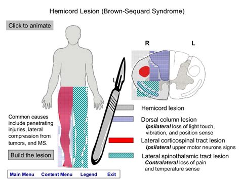 Spinal cord lesions module