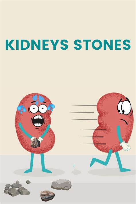 1. Calcium stones. Most kidney stones are calcium stones. 2. Struvite stones. Form in response ...