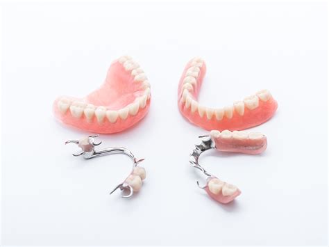 When can I wear my flippers after a dental implant?