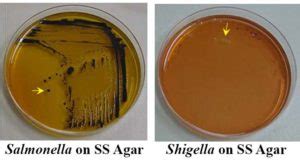 Salmonella Shigella (SS) Agar- Composition, Principle, Uses, Preparation and Result Interpretation