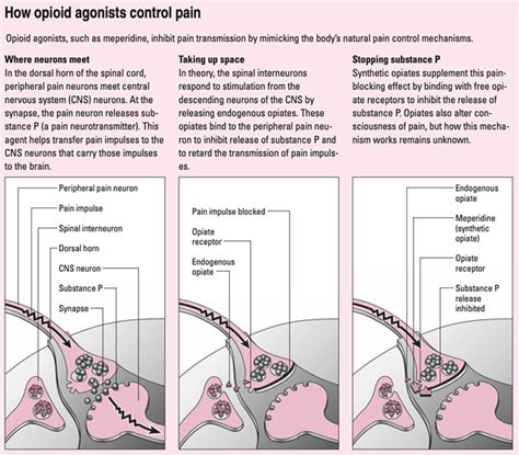 Opioid Agonists – How Do They Work? | Lippincott NursingCenter