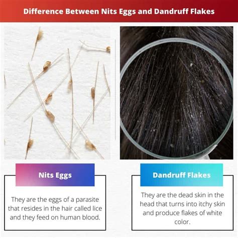 Nits Eggs vs Dandruff Flakes: Difference and Comparison