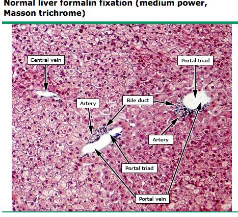 Liver Histology Labeled | Liver Histology Labeled Normal liver histology | Medical science, Bile ...