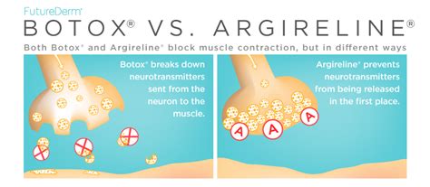 Botox vs Argireline | Argireline, Botox, Effective skin care routine