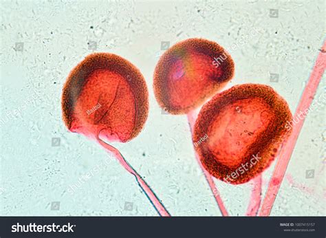 Rhizopus Sporangia Under Microscope Stock Photo 1007415157 | Shutterstock