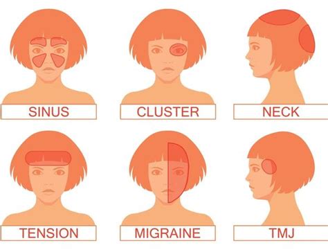 Cluster headache symptoms: What is a cluster headache, how often do they happen? | Express.co.uk