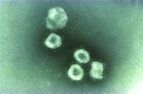 SARS-CoV-2 present significantly longer in stool than in respiratory ...