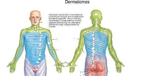 UE Dermatomes Diagram Diagram | Quizlet