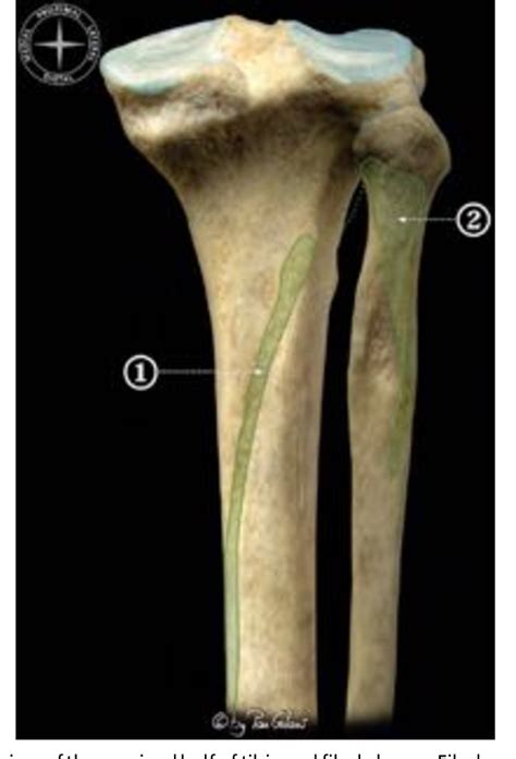 Figure 11 from Anatomy of the triceps surae: a pictorial essay. | Semantic Scholar