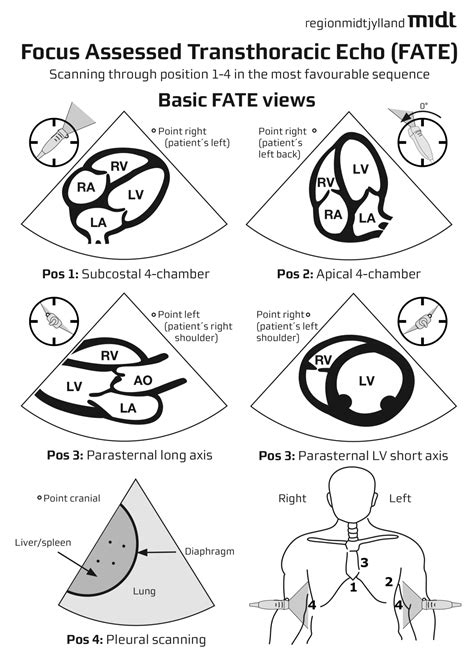 Focused Cardiac Ultrasound (FATE) - USabcd