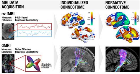 Noninvasive MRI based methods to estimate brain connectivity. Top:... | Download Scientific Diagram