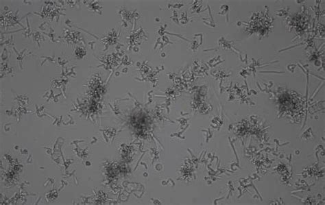 Bacterial Contamination Cell Culture