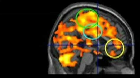 Scans 'show mindfulness meditation brain boost' - BBC News