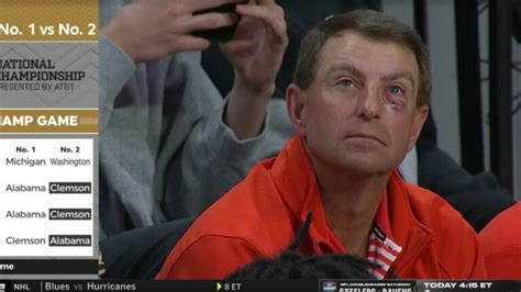 Dabo Swinney goes viral for attending Clemson game with black eye