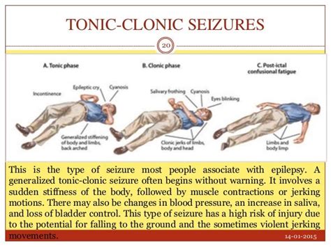 Brain Post: Skier's Avalanche Burial Injury Leads to Sudoku-Induced Seizures - SnowBrains