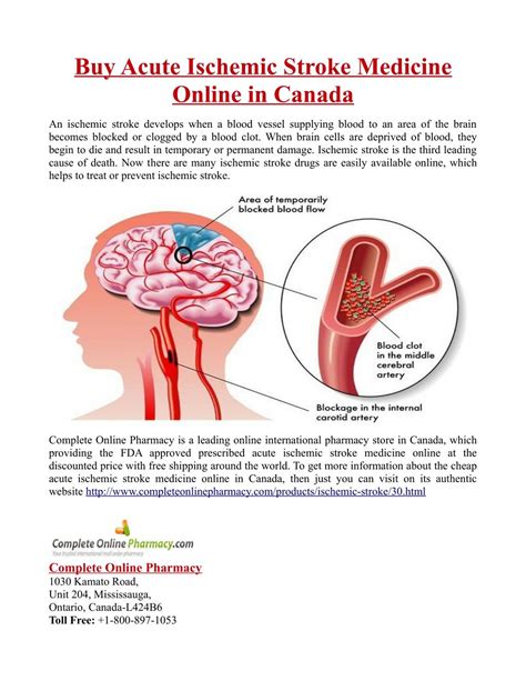 PPT - Buy Acute Ischemic Stroke Medicine Online in Canada PowerPoint Presentation - ID:7420340