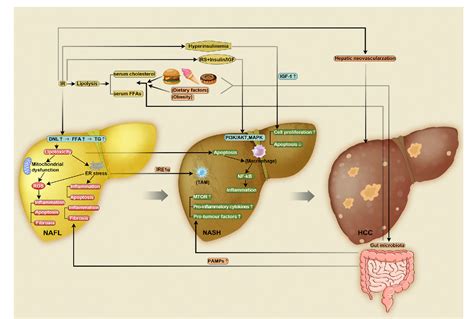 Figure 1 from The Pathogenesis of HCC Driven by NASH and the Preventive ...