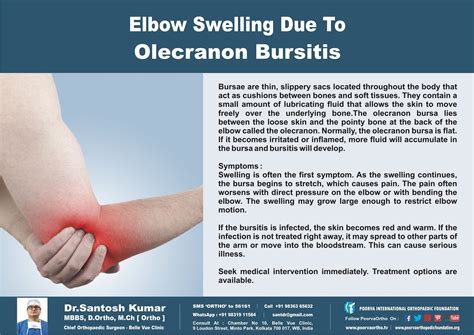 Elbow Swelling due to Olecranon Bursitis. Know it. Check if you have these symptoms. Call ...