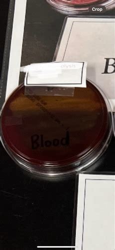 Blood agar plate Flashcards | Quizlet