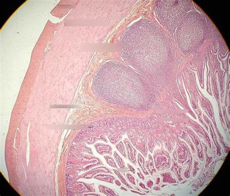 Ileum Diagram | Quizlet